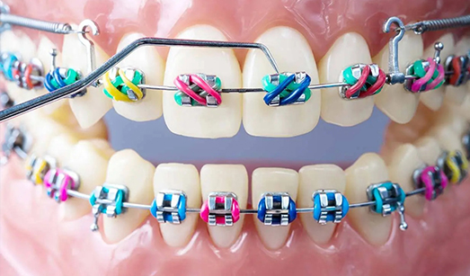Cosmetic Dentistry Clinic Kolkata