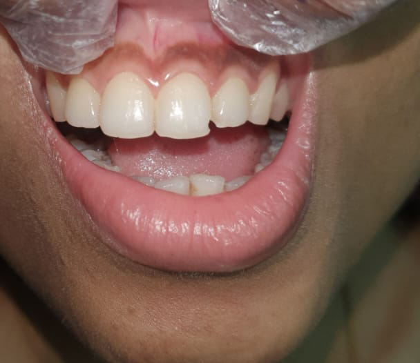 Best Dental Clinic Kolkata