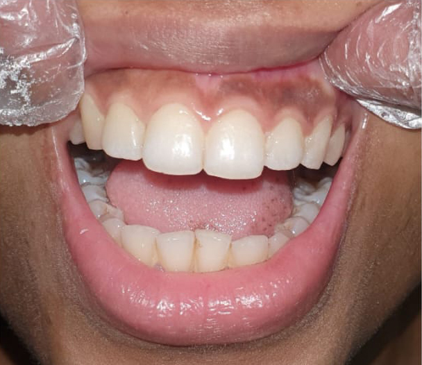 Cosmetic Dentistry Clinic Kolkata