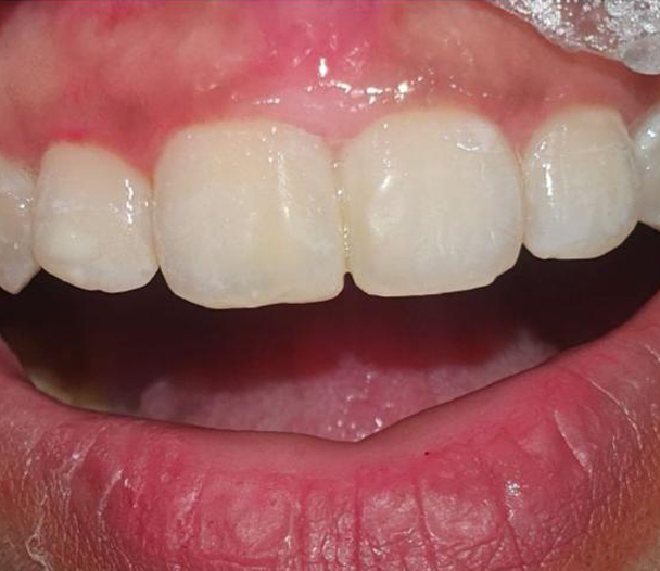 Dental Oral Surgery Kolkata