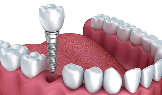 Dental Oral Surgery Kolkata