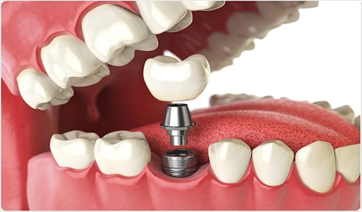 Best Dental Clinic Kolkata