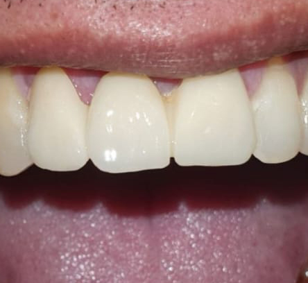 Dental Oral Surgery Kolkata