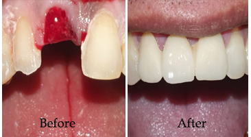 Best Dental Clinic Kolkata