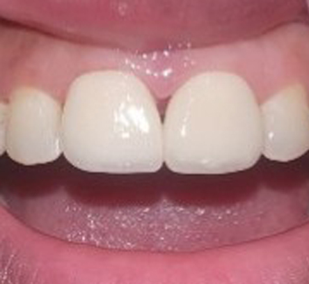 Cosmetic Dentistry Clinic Kolkata
