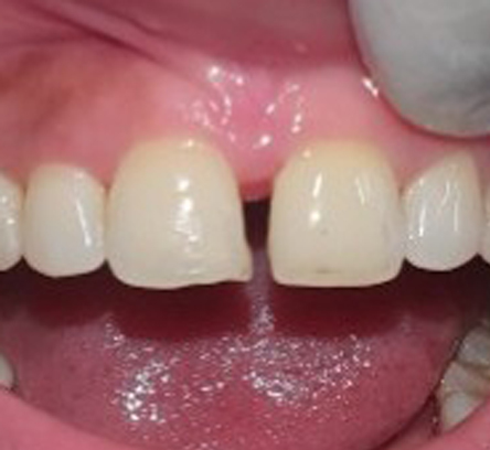 Best Dental Clinic Kolkata