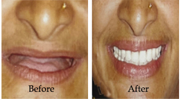 Cosmetic Dentistry Clinic Kolkata