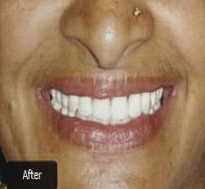 Dental Oral Surgery Kolkata