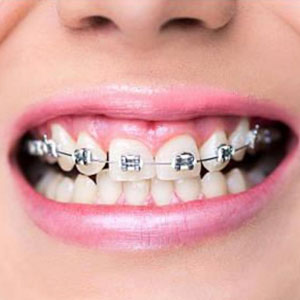Best Dental Clinic Kolkata