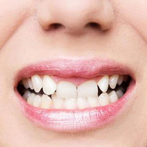 Cosmetic Dentistry Clinic Kolkata