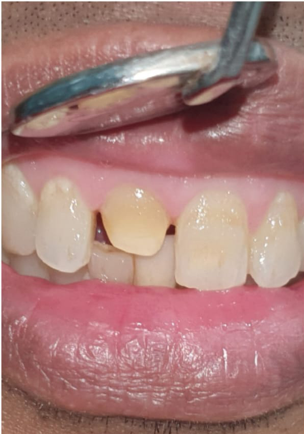 Oral and Maxillofacial Surgery Kolkata
