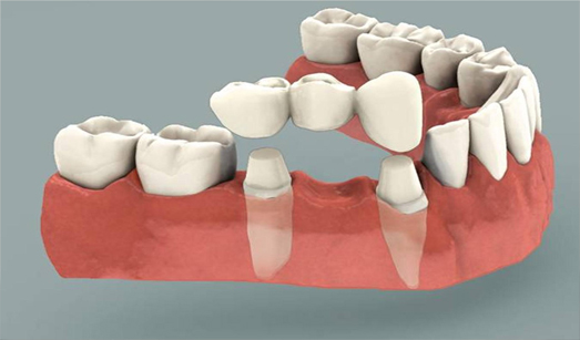 Dental Oral Surgery Kolkata