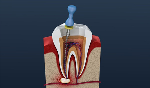 Oral and Maxillofacial Surgery Kolkata