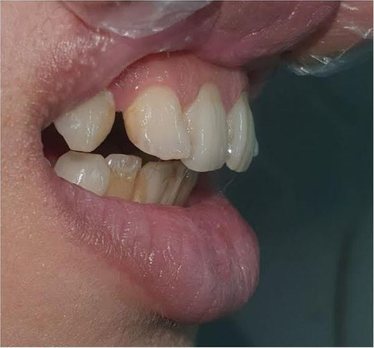 Oral and Maxillofacial Surgery Kolkata