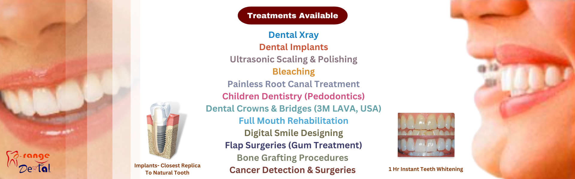Dental Implants Kolkata