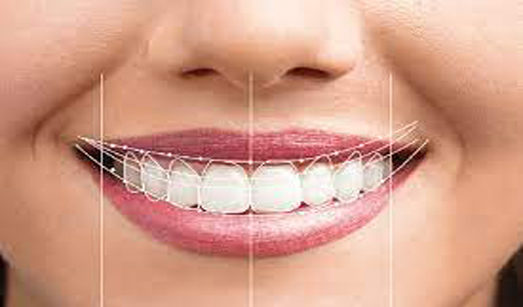 Dental Implants Kolkata