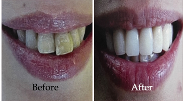 Dental Oral Surgery Kolkata
