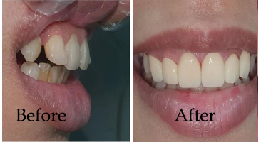 Oral and Maxillofacial Surgery Kolkata